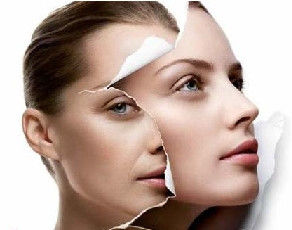 Tighten Forehead Crows White Microneedle Fractional Rf Machine Neck Wrinkles